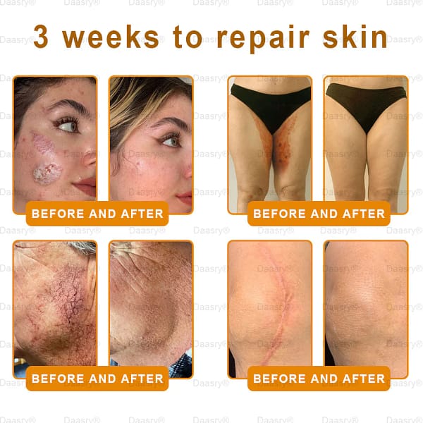 Daasry® "Golden Elixir" Botox Bee Venom Skin Restoration Cream - Image 5