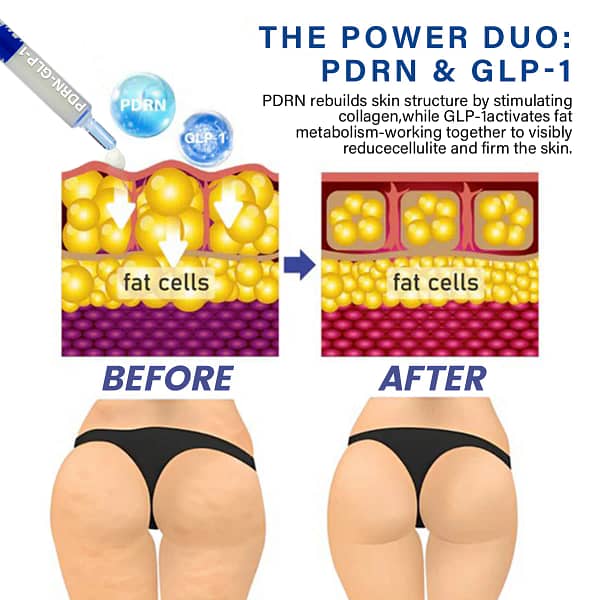 Oveallgo® PDRN-GLP-1 Slimming & Blood Sugar Regulating Reedle Shot Serum