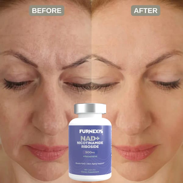 Furnexis NAD+ Nicotinamide Riboside Plus