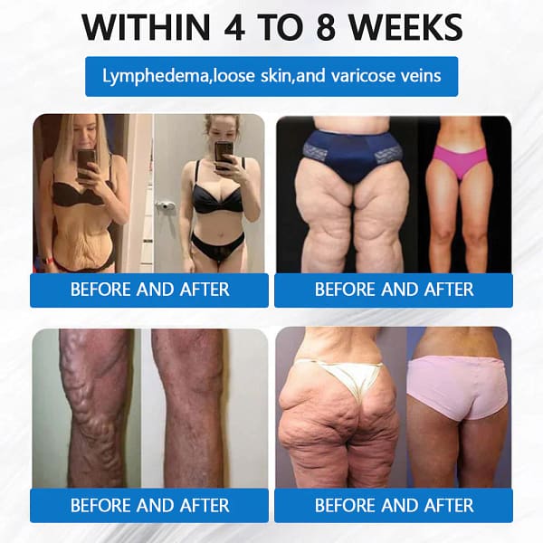 ADFIRE® SMGT-GLP-1 Tirzepatide & Collagen Nano Microneedle Weight Loss Patch - Image 6