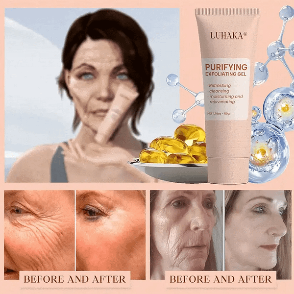 Luhaka® Purifying Exfoliating Gel for Acanthosis Nigricans