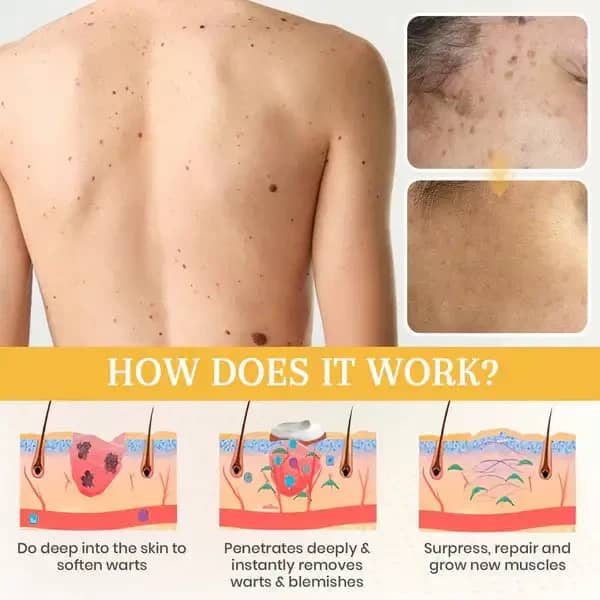 ATTDX® NatureStore Instant Mole & Spot Cream