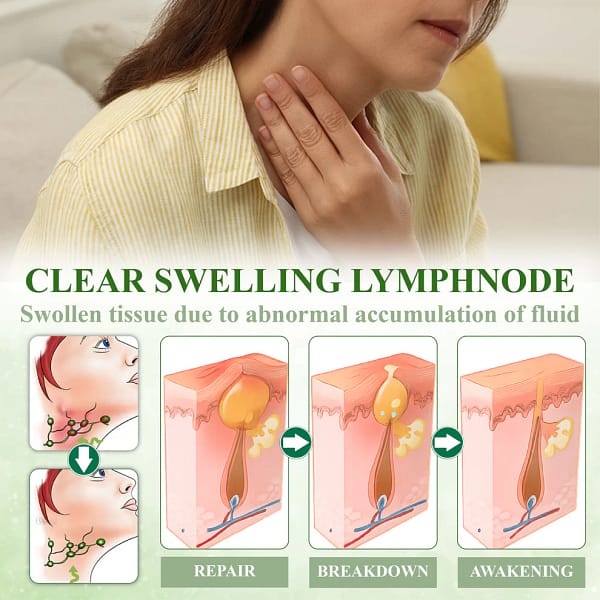 ATTDX® SwellSoothe Lymphatic Cream