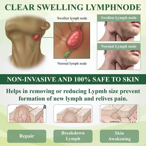 ATTDX® SwellSoothe Lymphatic Cream