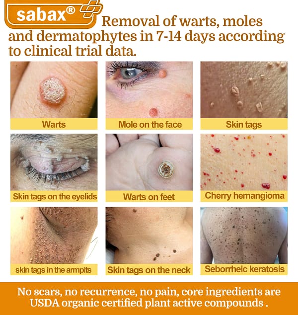 sabax® Bee Venom Comprehensive Cream - Image 2