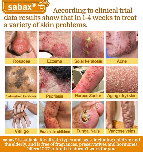 sabax® Bee Venom Comprehensive Cream - Image 5