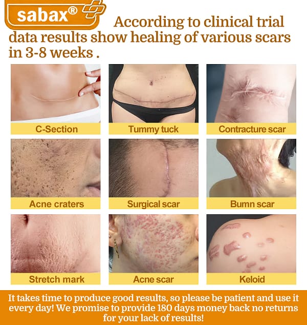 sabax® Bee Venom Comprehensive Cream - Image 9