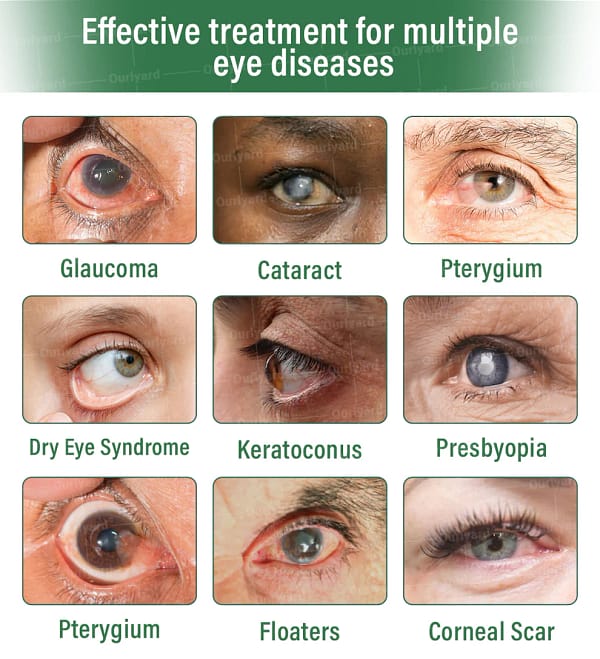 Ourlyard® ClariTech Nano Eye Drops