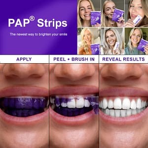 Flysmus® V34 Whitening Strips