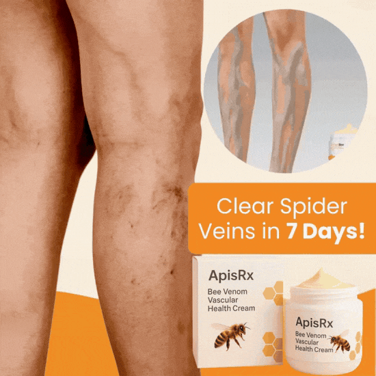 ApisRx Anti-Varicose Cream | Visible Relief