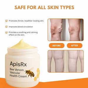 ApisRx Anti-Varicose Cream | Visible Relief