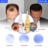 Regrow your hair in 120 days with STEM Cell Complete Hair Cycle Solution 2.0 or your money back