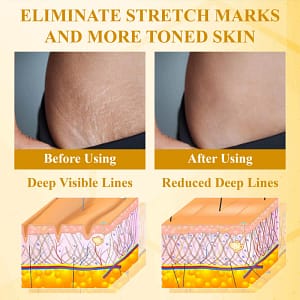 LOVILDS™ BotoxBee Advanced Multi Action Firming Cream