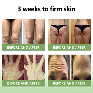 LOVILDS™ Luxurious Collagen Firming Cream
