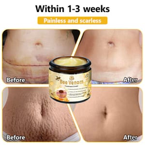 Turonu™ Bee Venom Treatment Cream
