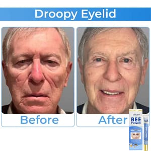 LOVILDS™ Collagen+ Bee Poison Wake Up Eye Cream