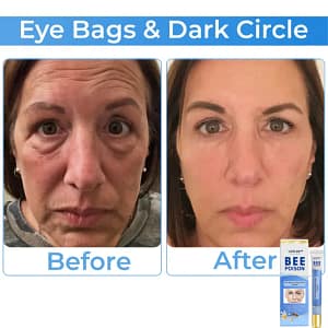 LOVILDS™ Collagen+ Bee Poison Wake Up Eye Cream