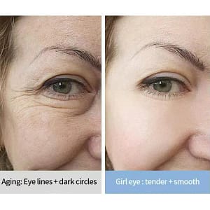 Lovilds™ Electric Anti Wrinkle Eye Cream