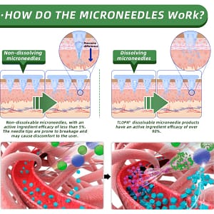 TLOPA® SMGT-GLP-1 Nano Microneedle Patch