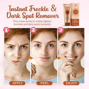 LOVILDS™ Whitening and Freckle – Removing Mask