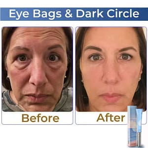 Lovilds™ Electric Anti Wrinkle Eye Cream