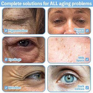 LOVILDS™ Collagen+ Bee Poison Wake Up Eye Cream