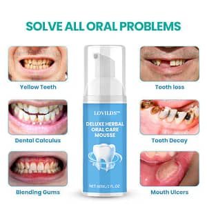 LOVILDS™ Deluxe Herbal Oral Care Mousse- Solve all Oral Problems