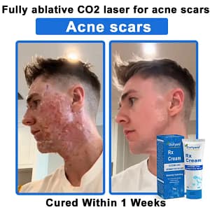 Ourlyard® OatCalm Skin Repair Cream