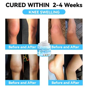 LOVILDS™ 7 Day Rapid Joint & Bone Therapy Cream