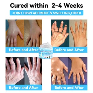 LOVILDS™ 7 Day Rapid Joint & Bone Therapy Cream