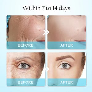 LOVILDS™ Anti-Wrinkle Face Mask