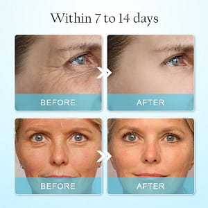LOVILDS™ Anti-Wrinkle Face Mask
