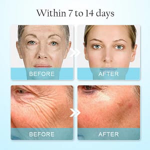 LOVILDS™ Anti-Wrinkle Face Mask