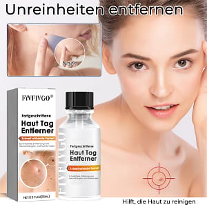 Fivfivgo® Bee Venom Tags & Moles Remover