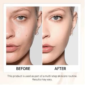 LOVILDS™ Achieve Flawless Skin