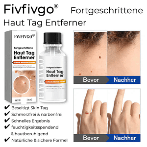 Fivfivgo® Bee Venom Tags & Moles Remover