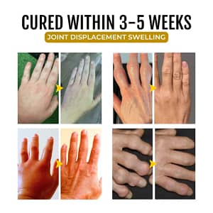 LOVILDS™ArthroSoothe Turmeric & Emu Oil Pain Relief Massage Gel