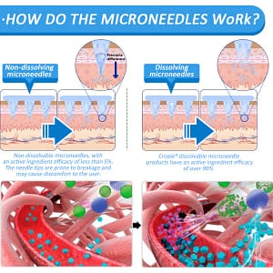 CROAIE Nano Microneedle Patch