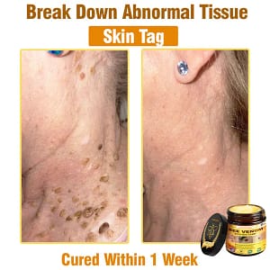 LOVILDS™ Bee Venom All-in-One Cream