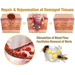 LOVILDS™ TagRecede Bee Venom Treatment Cream