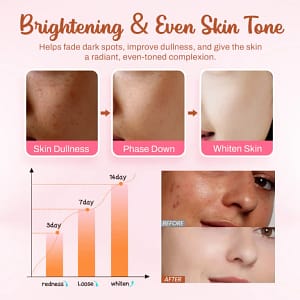 LOVILDS™ Whitening and Freckle – Removing Mask