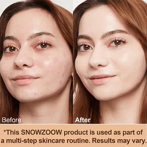 LOVILDS™ Achieve Flawless Skin