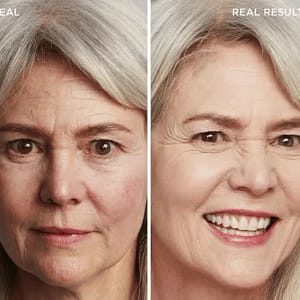 LOVILDS™ Achieve Flawless Skin