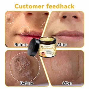 LOVILDS™ Bee Venom Skin Treatment Cream