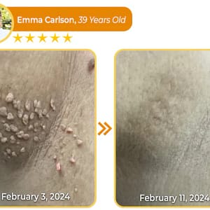 Lovilds™ Natural Black Soap – The Ultimate Solution for Skin Health & Healing