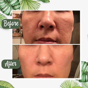 LOVILDS™ Purifying and Antibacterial Green Tea Mask