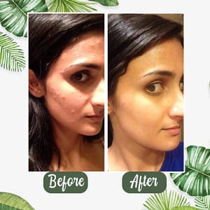 LOVILDS™ Purifying and Antibacterial Green Tea Mask