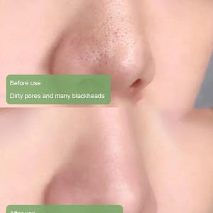 LOVILDS™ Purifying and Antibacterial Green Tea Mask