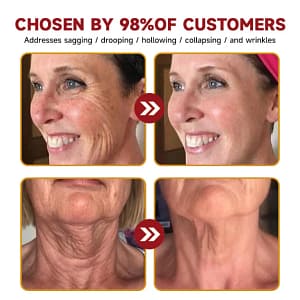 LOVILDS™ Toxin Bee Poison Anti-Aging Wrinkle Serum