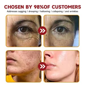 LOVILDS™ Toxin Bee Poison Anti-Aging Wrinkle Serum